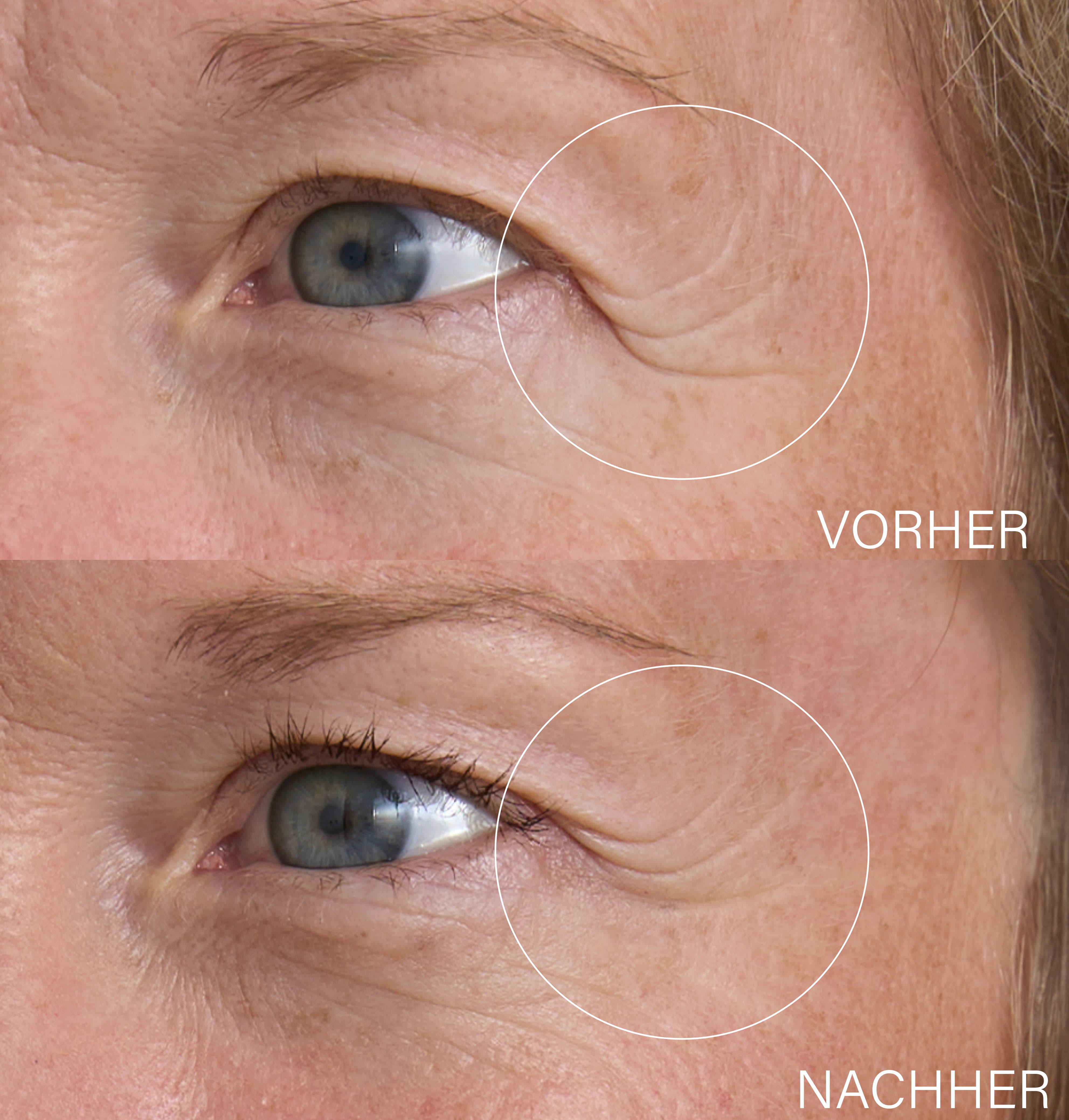 Advanced Slow-Aging Set