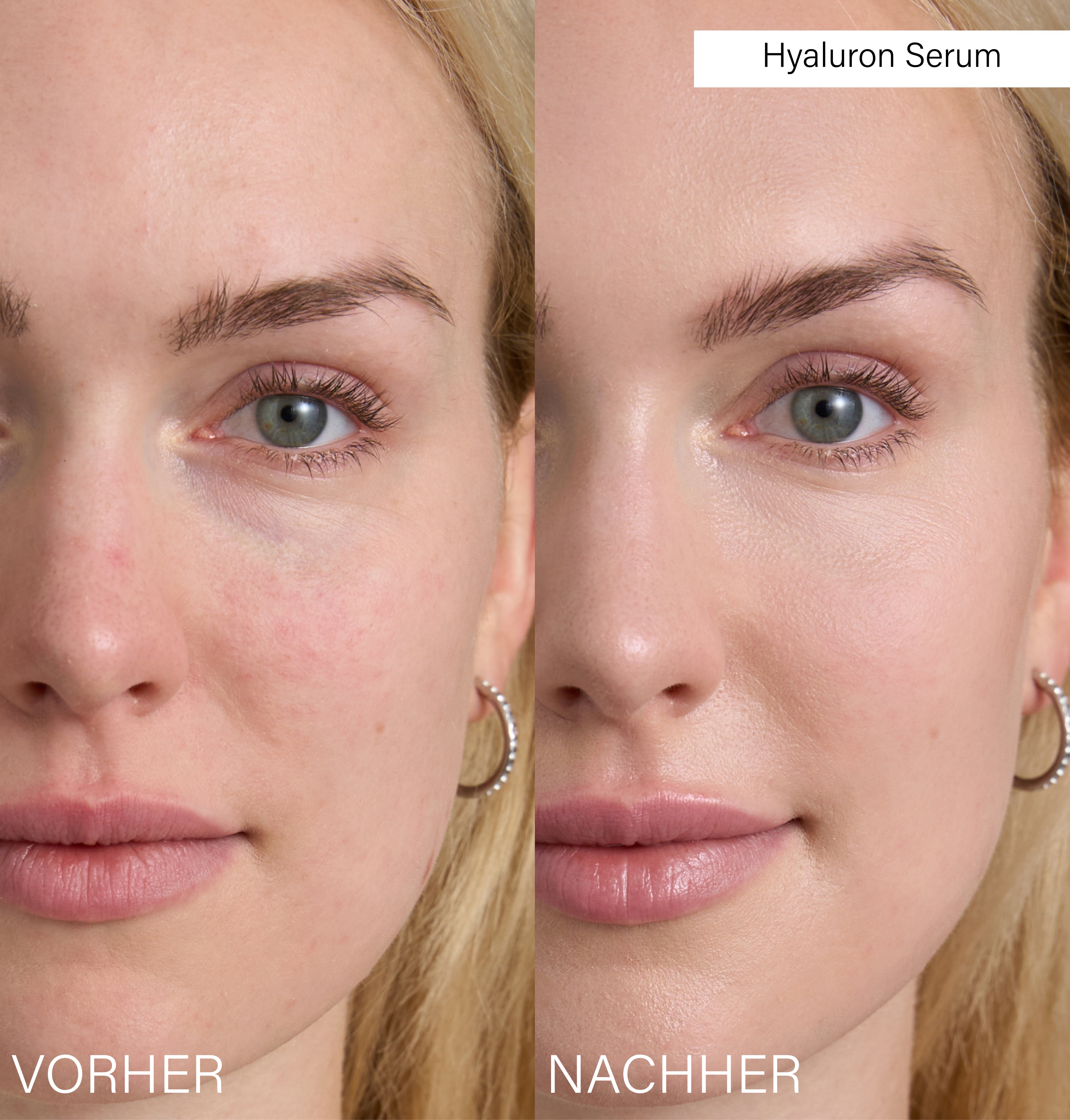 Advanced Slow-Aging Set