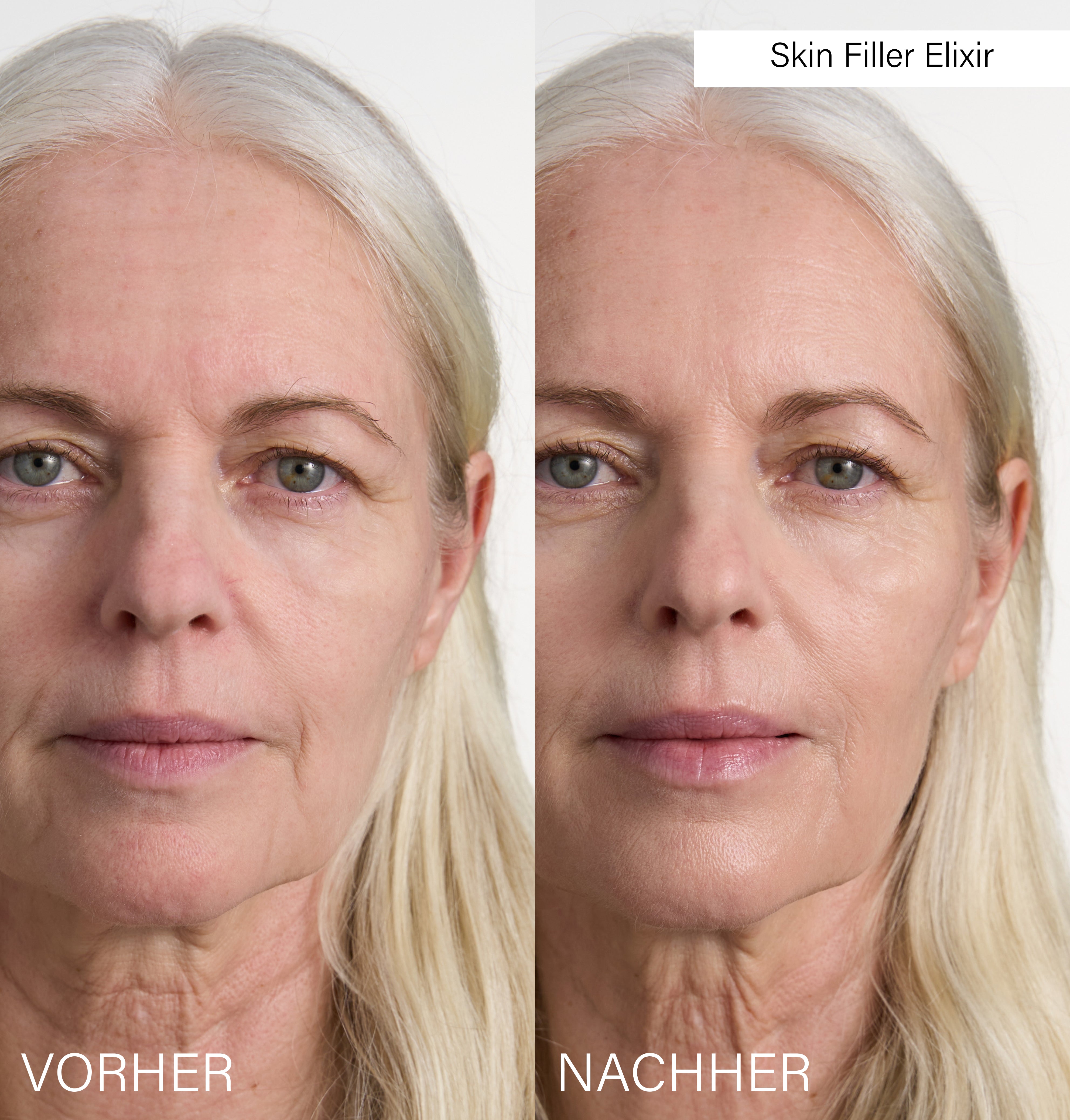 Botanical Filler Set