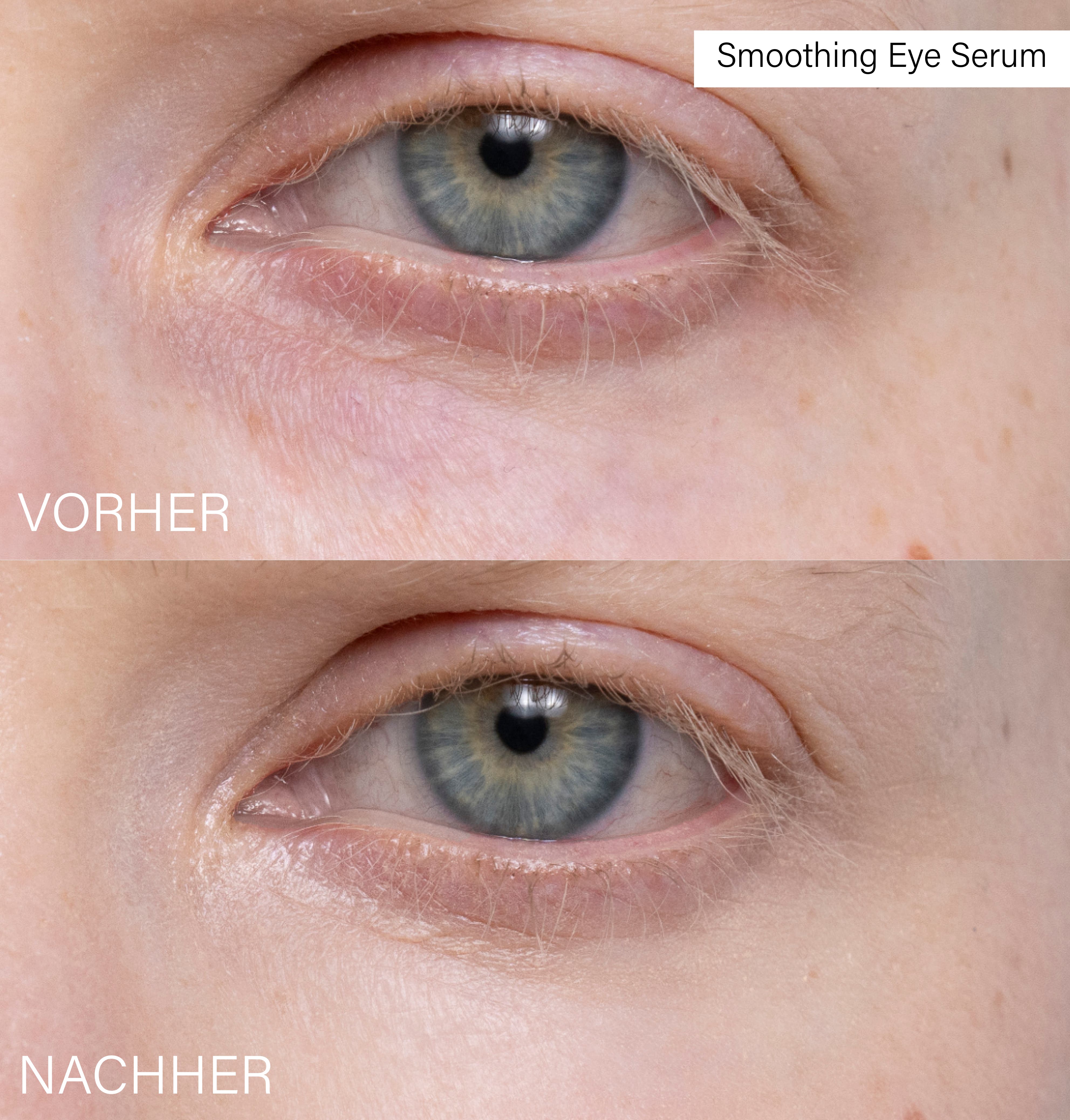 Smoothing Eye Serum