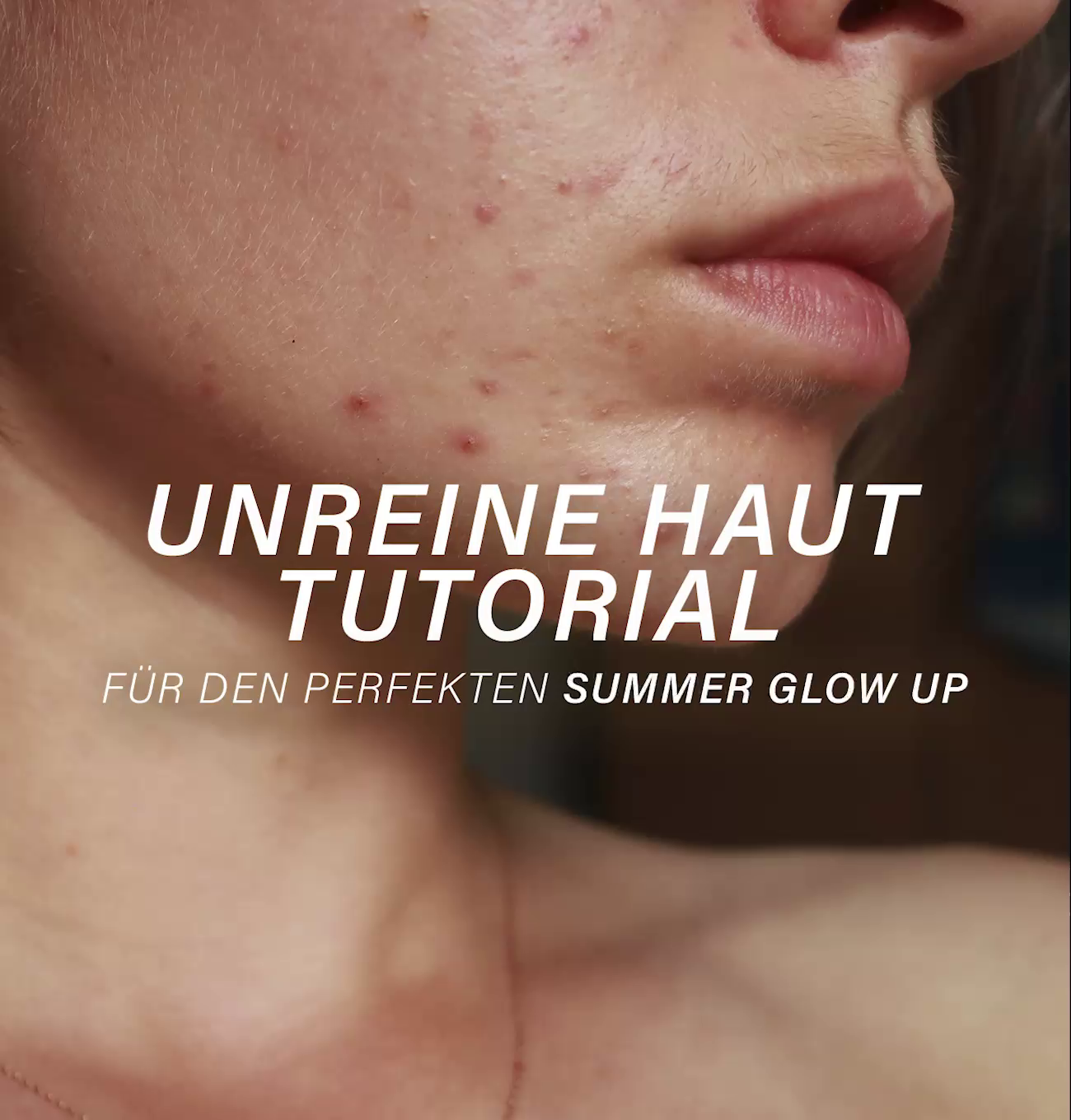 Free Summer Unreine Haut Tutorial
