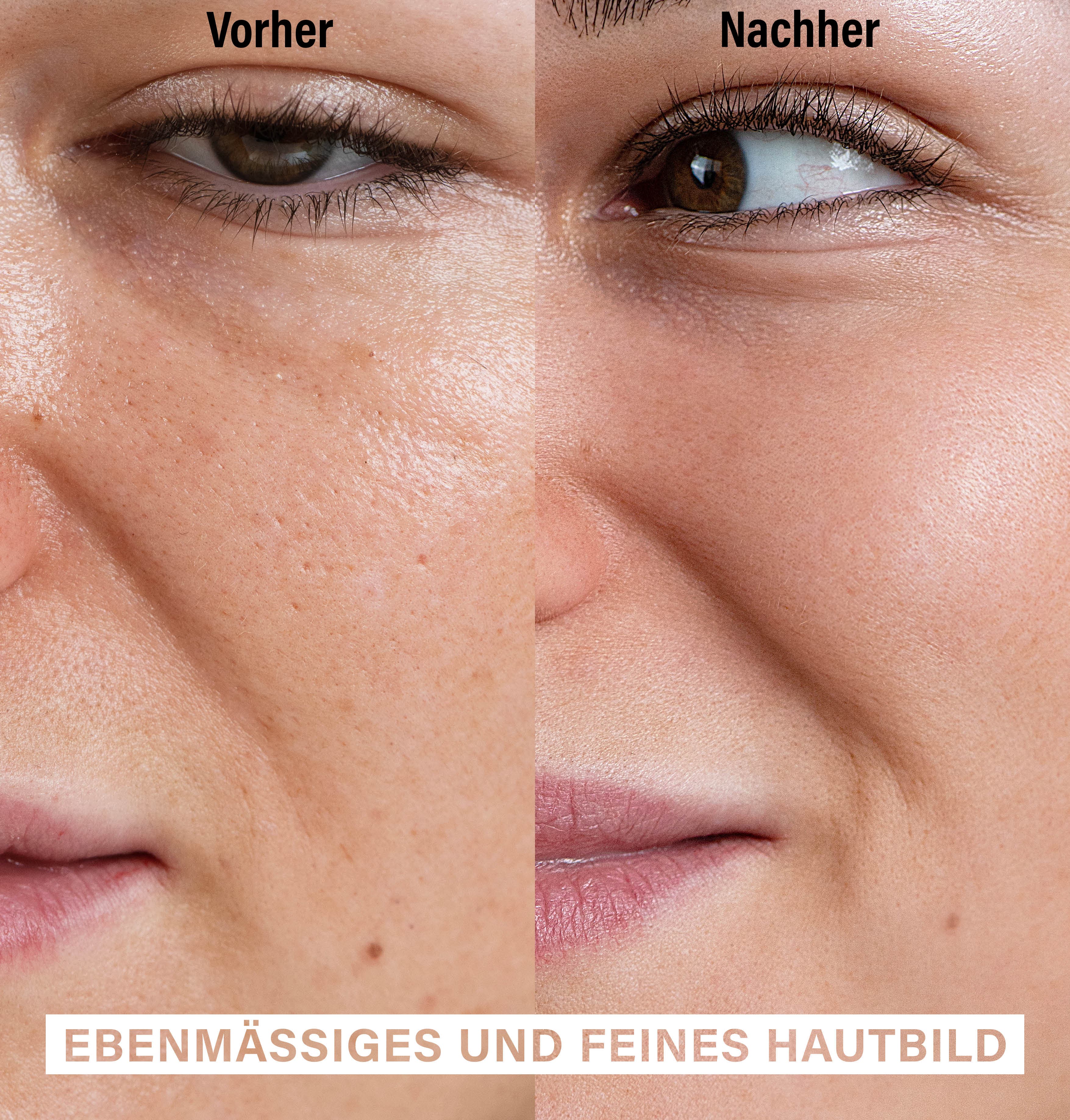 Skin Exfoliating Peeling