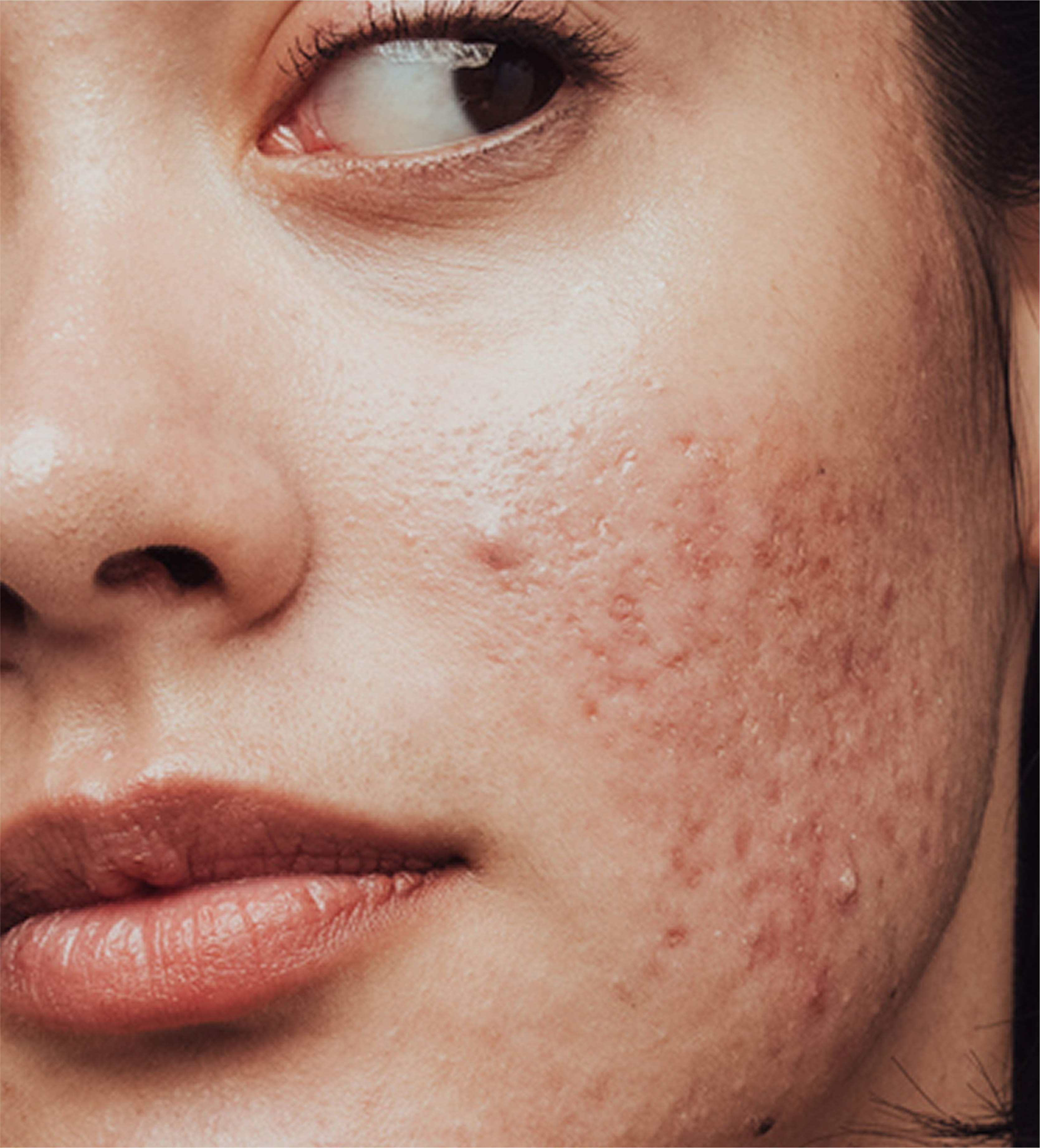 Mary Rose Bio Gesichtsserum Mit Vitamin E – Anti-Aging, Lifting-Effekt, Für Reife & Trockene Haut, Made In Italy