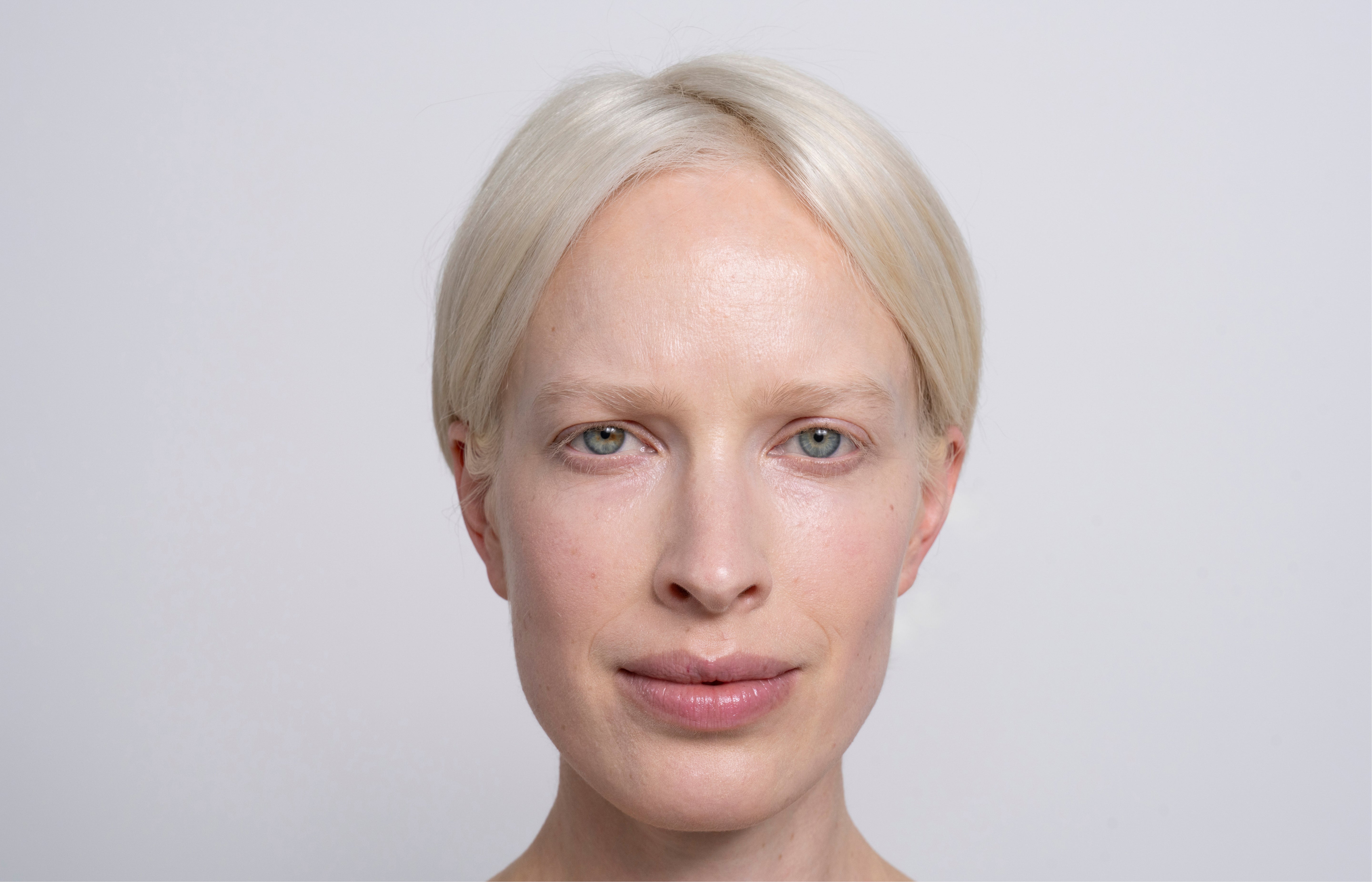 Frau mit weißen Haaren und blauen Augen blickt müde in die Kamera.