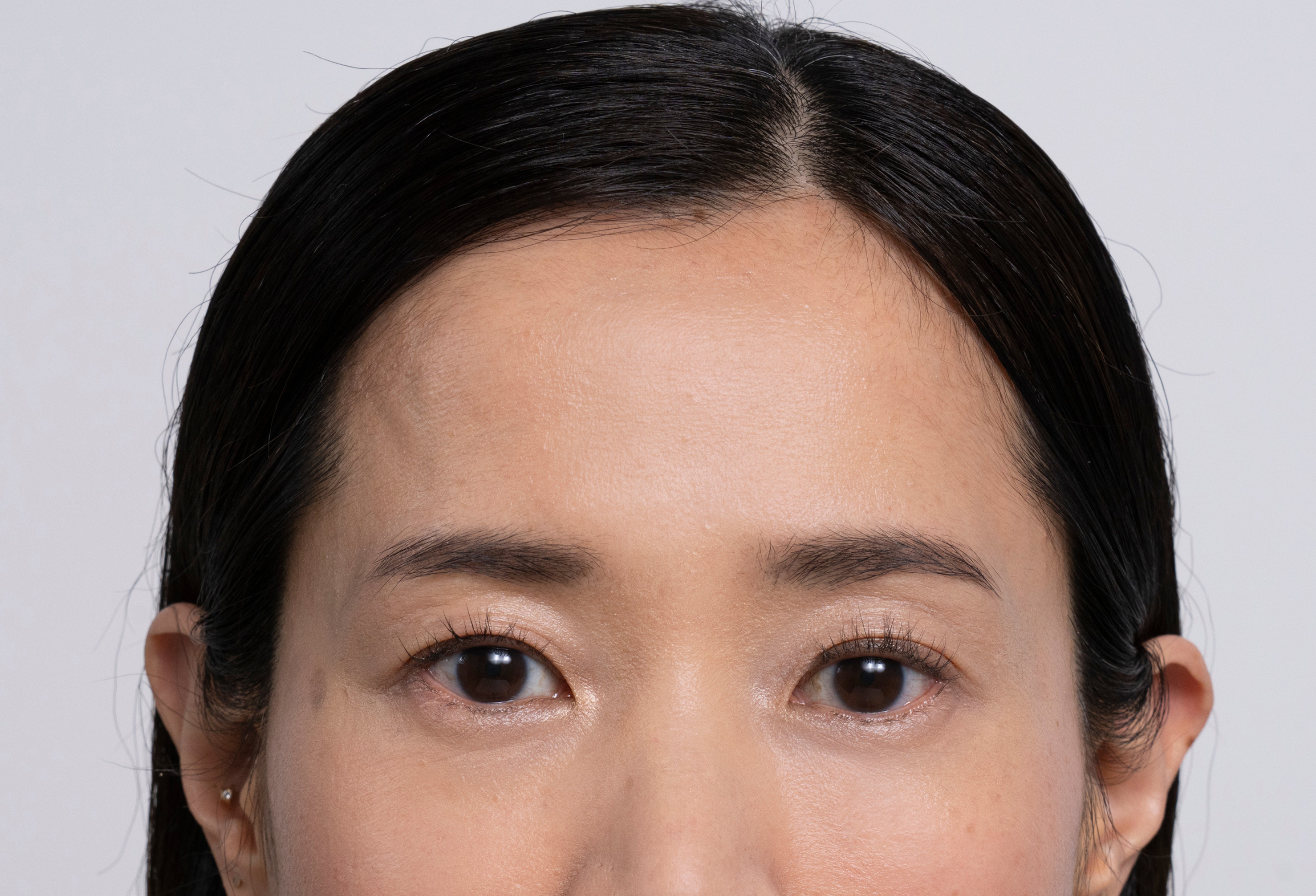 Teilportrait einer Frau mit glatter Stirn, reiner Haut und strahlender Augenpartie.