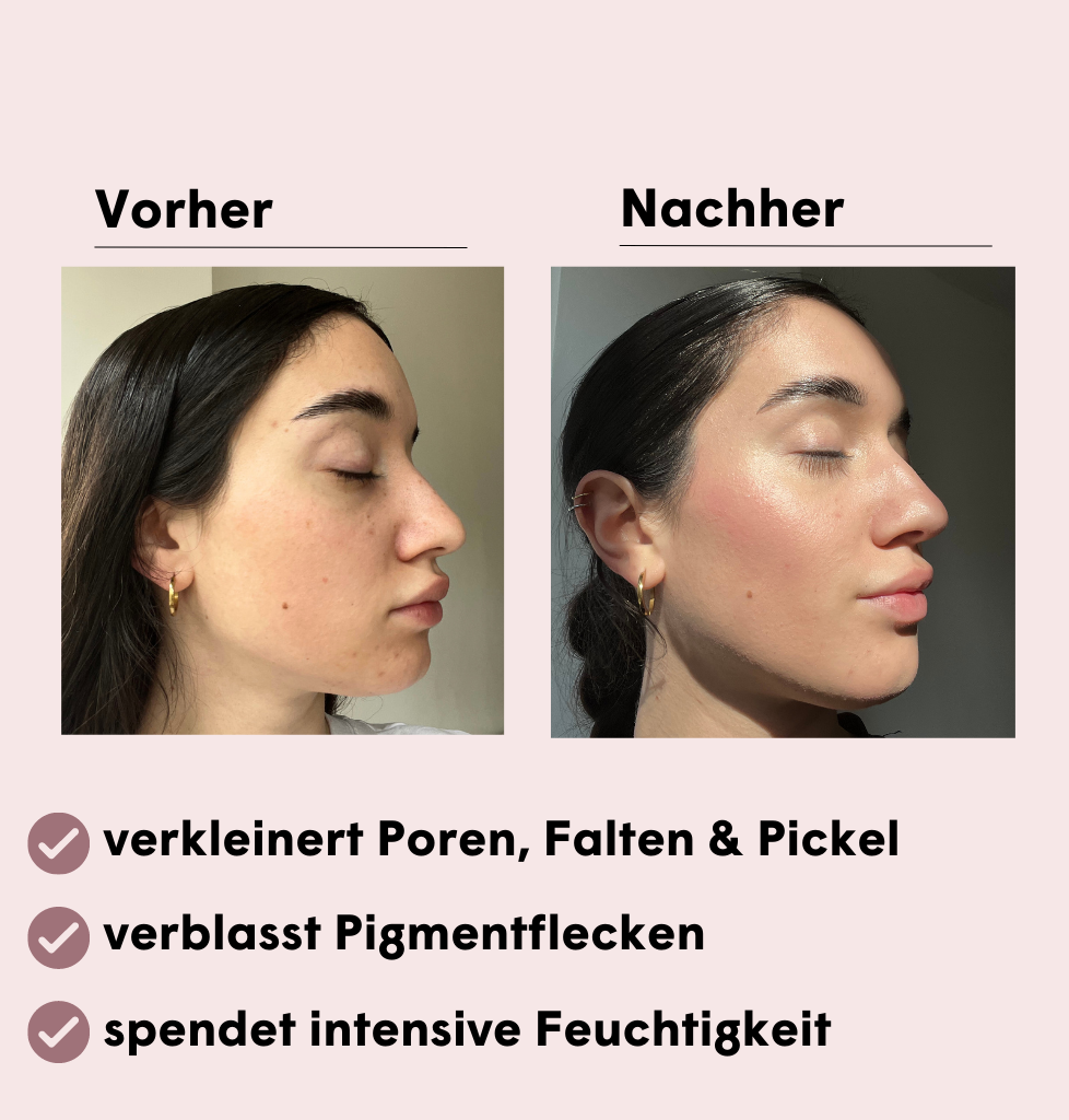Pore-Refining BB Set