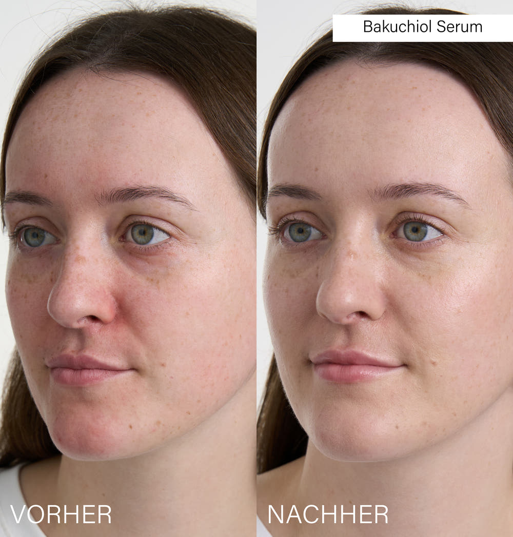 Bestseller Serum Set