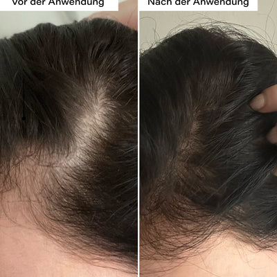Hair Growth Boost Duo