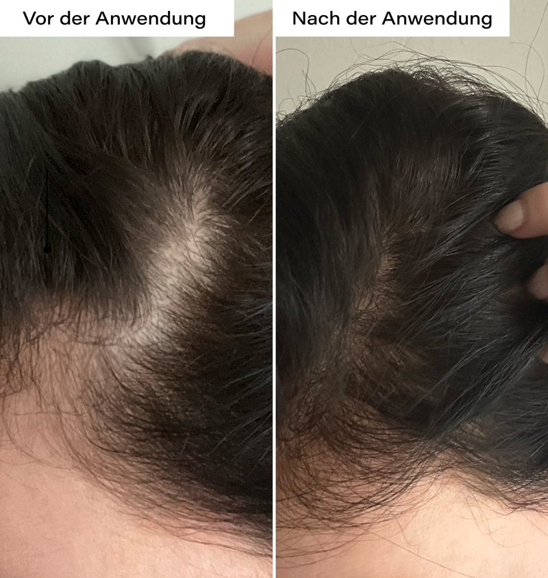 Hair Growth Boost Routine