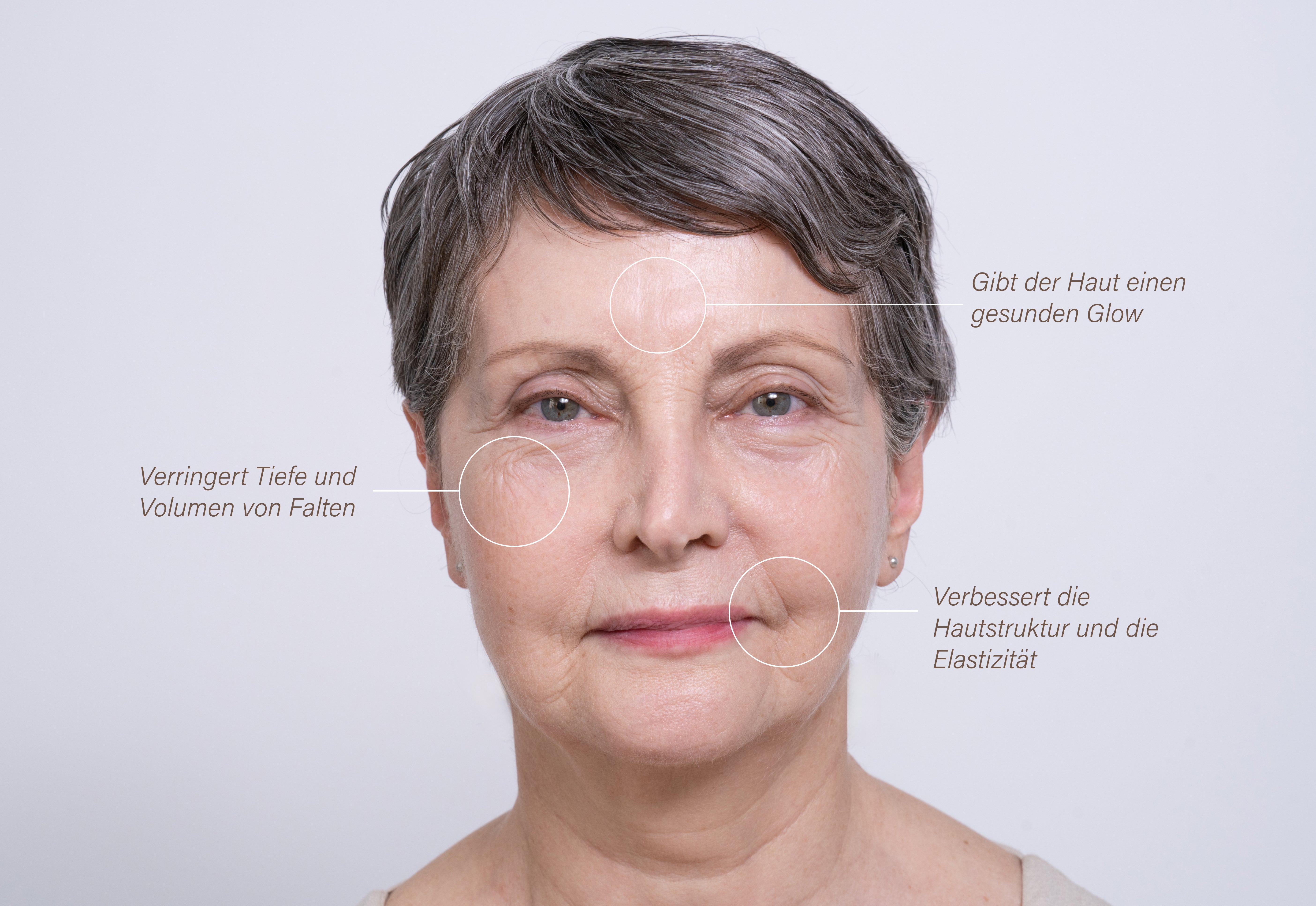 Portrait einer älteren Frau, bei der Stirn-, Augen- und Mundpartie jeweils mit einem Kreis markiert sind.