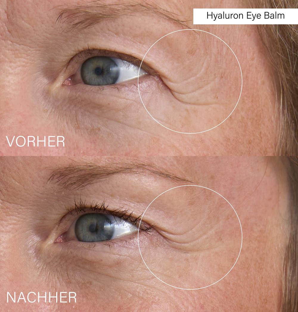 Day & Night Eye Balm Set