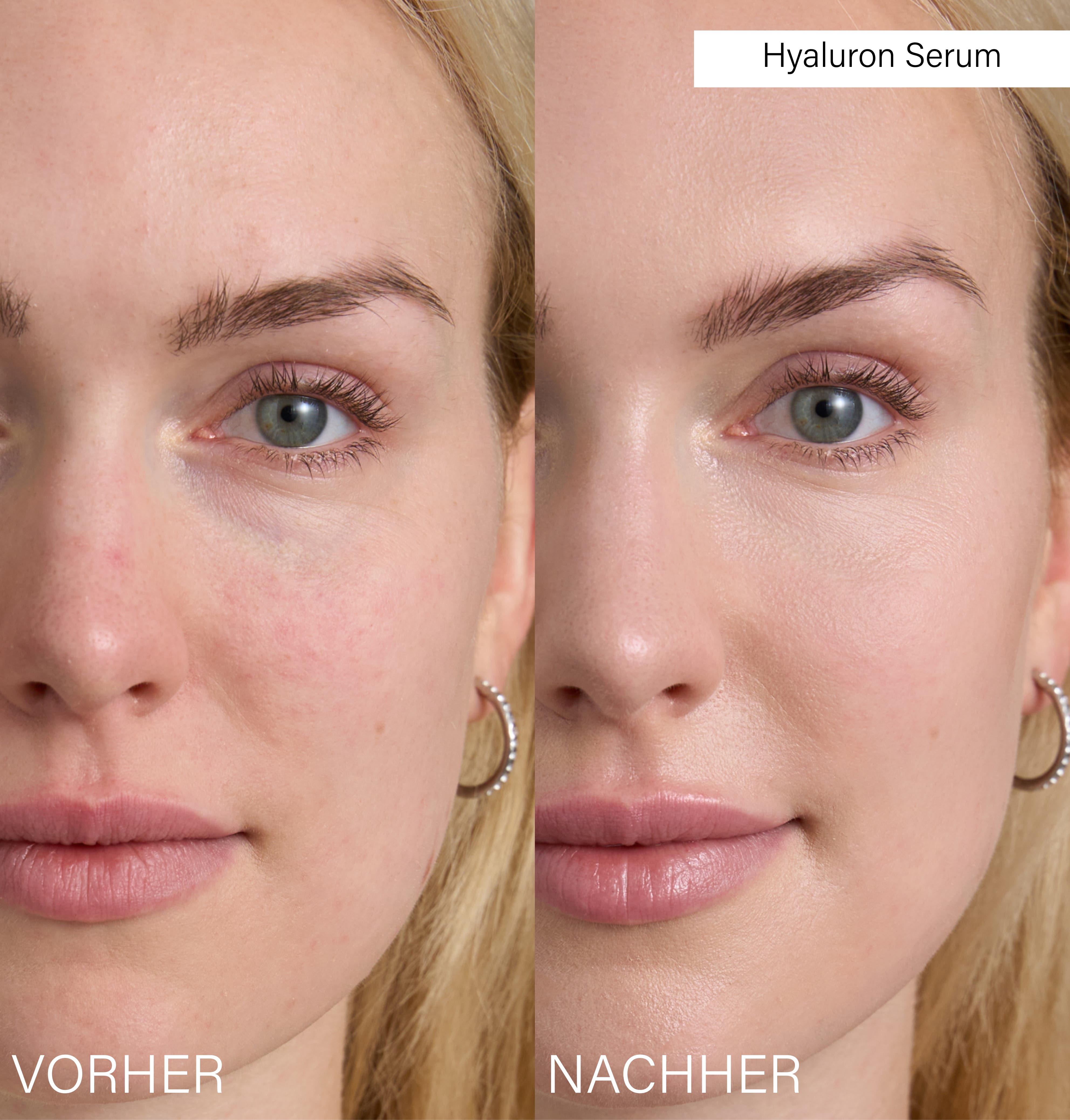 Day & Night Slow-Aging Serum Set