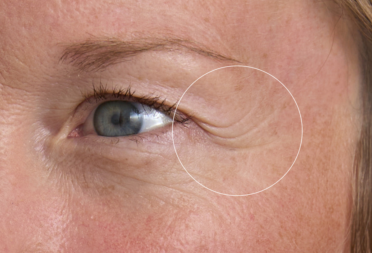 Full Lifting Eye Set