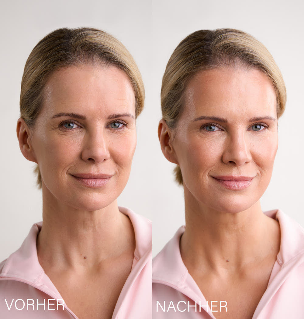 Lift & Calm Cupping Duo | by Monica Ivancan