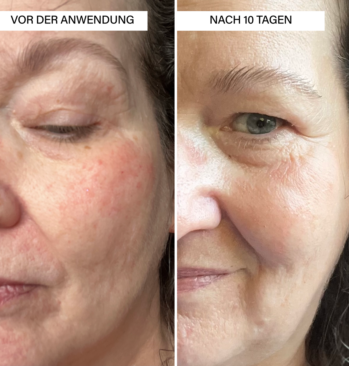 Brightening Serum | with Vitamin C & Botanics