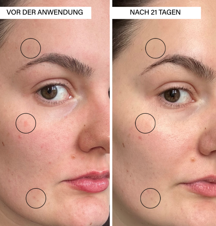 Brightening Serum | with Vitamin C & Botanics