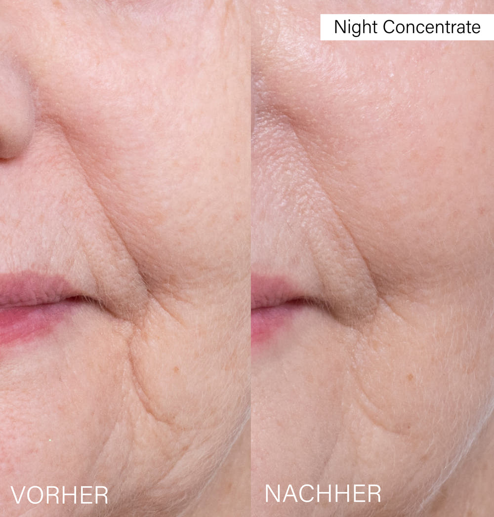 Day & Night Slow-Aging Serum Set