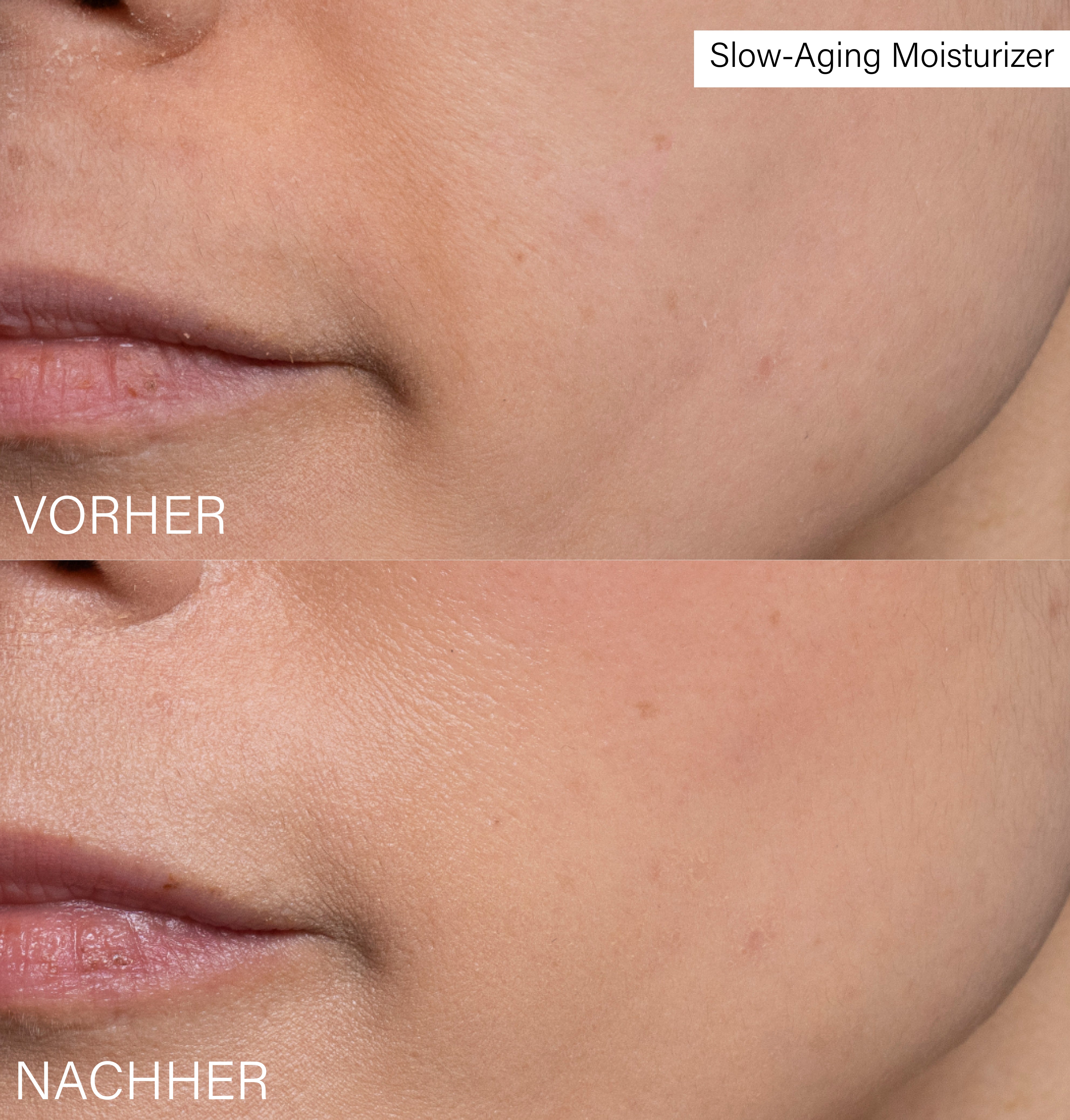 Slow-Aging Moisturizer