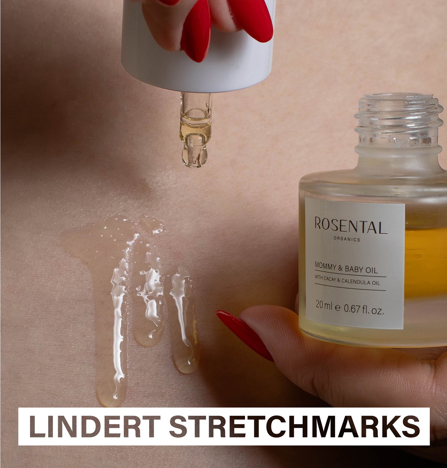 Stretch Mark Care Routine