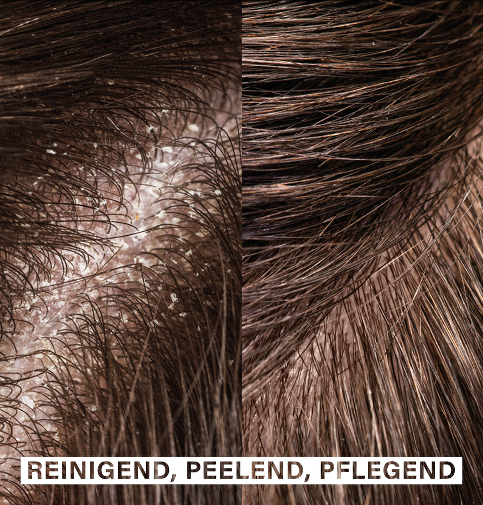 Exfoliating & Hydrating Hair Duo