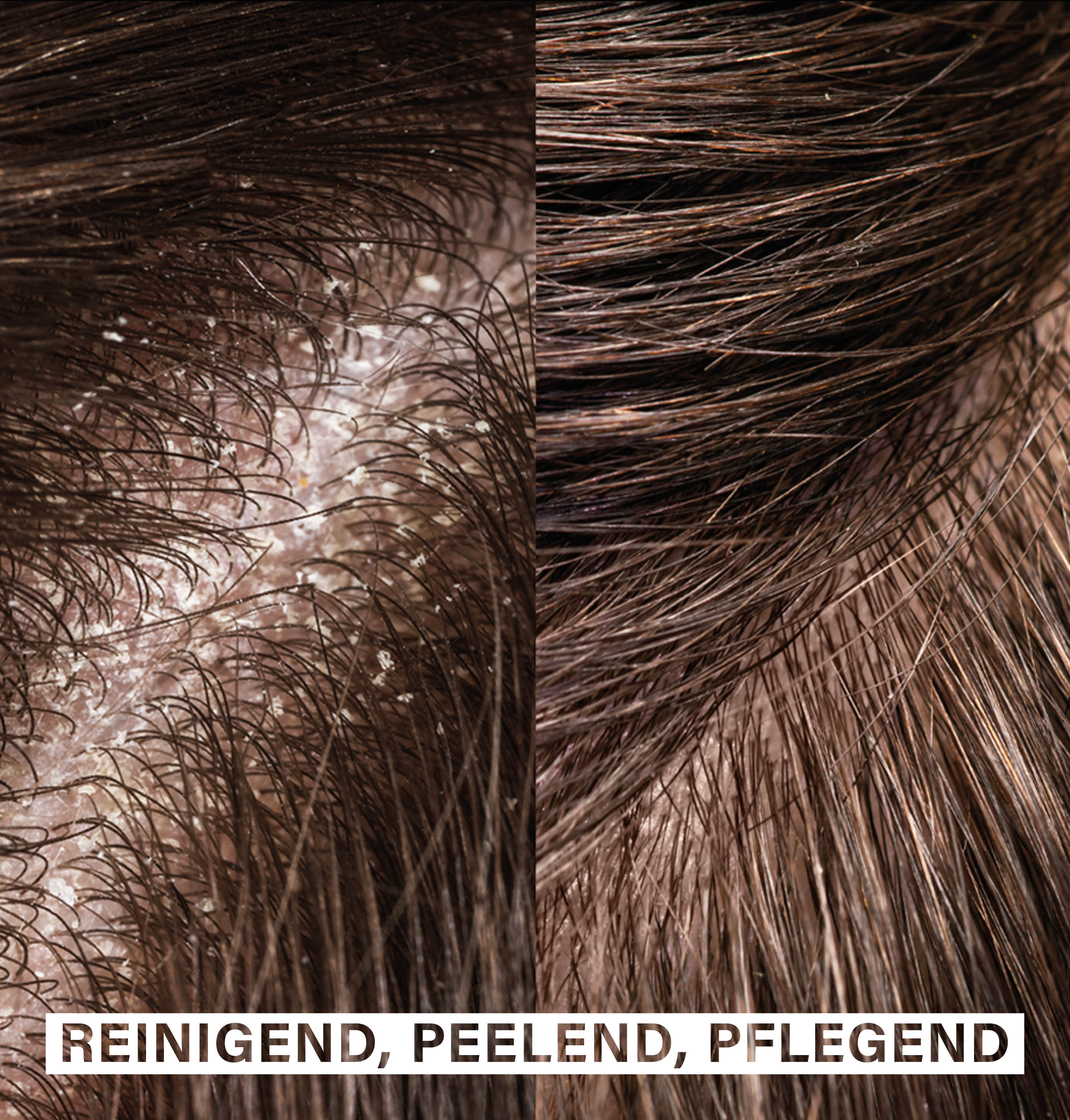 Exfoliating Hair Brush